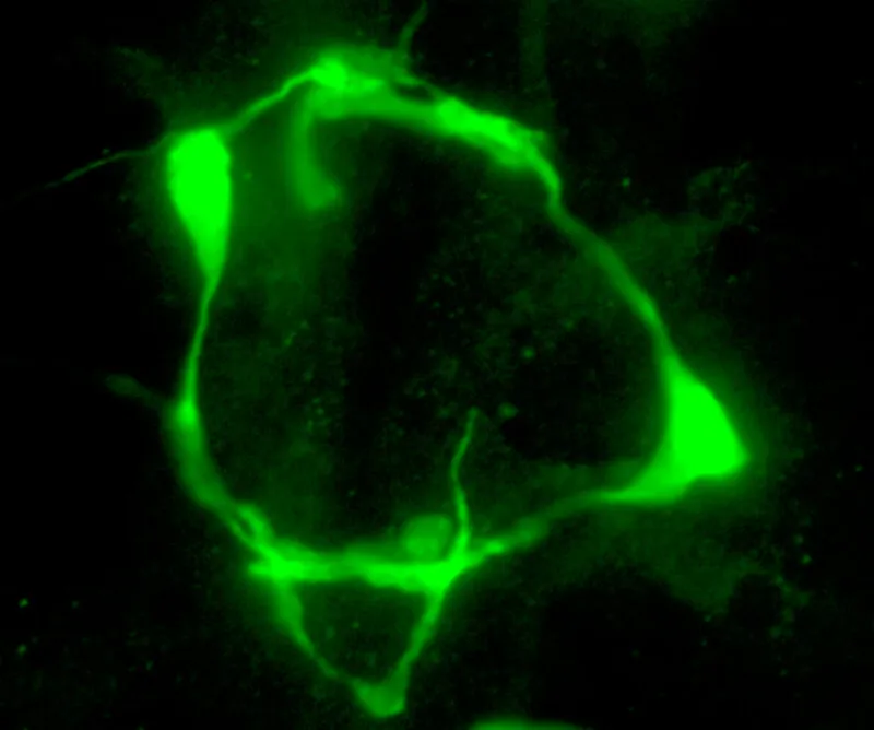 Marca de serotonina en las neuronas VC de Caenorhabditis elegans modificado genéticamente para expresar el transportador mod-5/SERT. En condiciones normales, estas células reprimen epigenéticamente esa función. Foto: Andrea Millán-Trejo / IBV-CSIC.