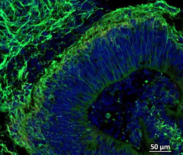Sección transversal de un organoide cerebral humano obtenida por microscopía de fluorescencia, donde las conexiones neuronales aparecen marcadas en verde y los núcleos celulares en azul. Foto: Vasso Apostolopoulou / Johns Hopkins Medicine.