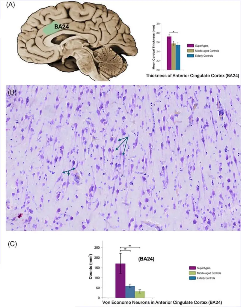 La corteza cingulada anterior (BA24) es más gruesa en los SuperAgers que en controles de mediana edad y ancianos (A). La micrografía (B) muestra neuronas de Von Economo en el cerebro de un SuperAger, presentes en densidad significativamente mayor que en el resto de grupos (C). Figura: Weintraub et al., Alzheimer's & Dementia, 2025 (CC BY).