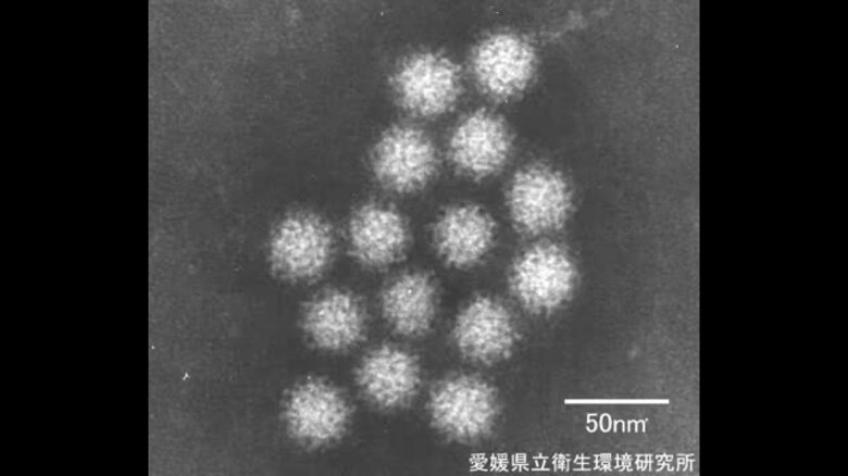 愛媛で感染性胃腸炎の感染が例年より高い水準続く　今治保健所エリアで急増　加熱調理や塩素消毒を【愛媛】｜FNNプライムオンライン