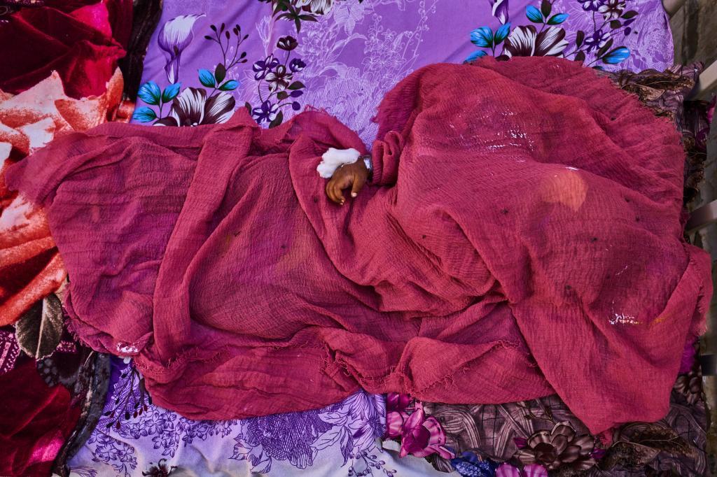 Envuelto en una tela, un ni�o duerme mientras recibe tratamiento en el centro de estabilizaci�n del hospital pedi�trico de Port Sudan, Sud�n, el mi�rcoles 15 de abril de 2026.