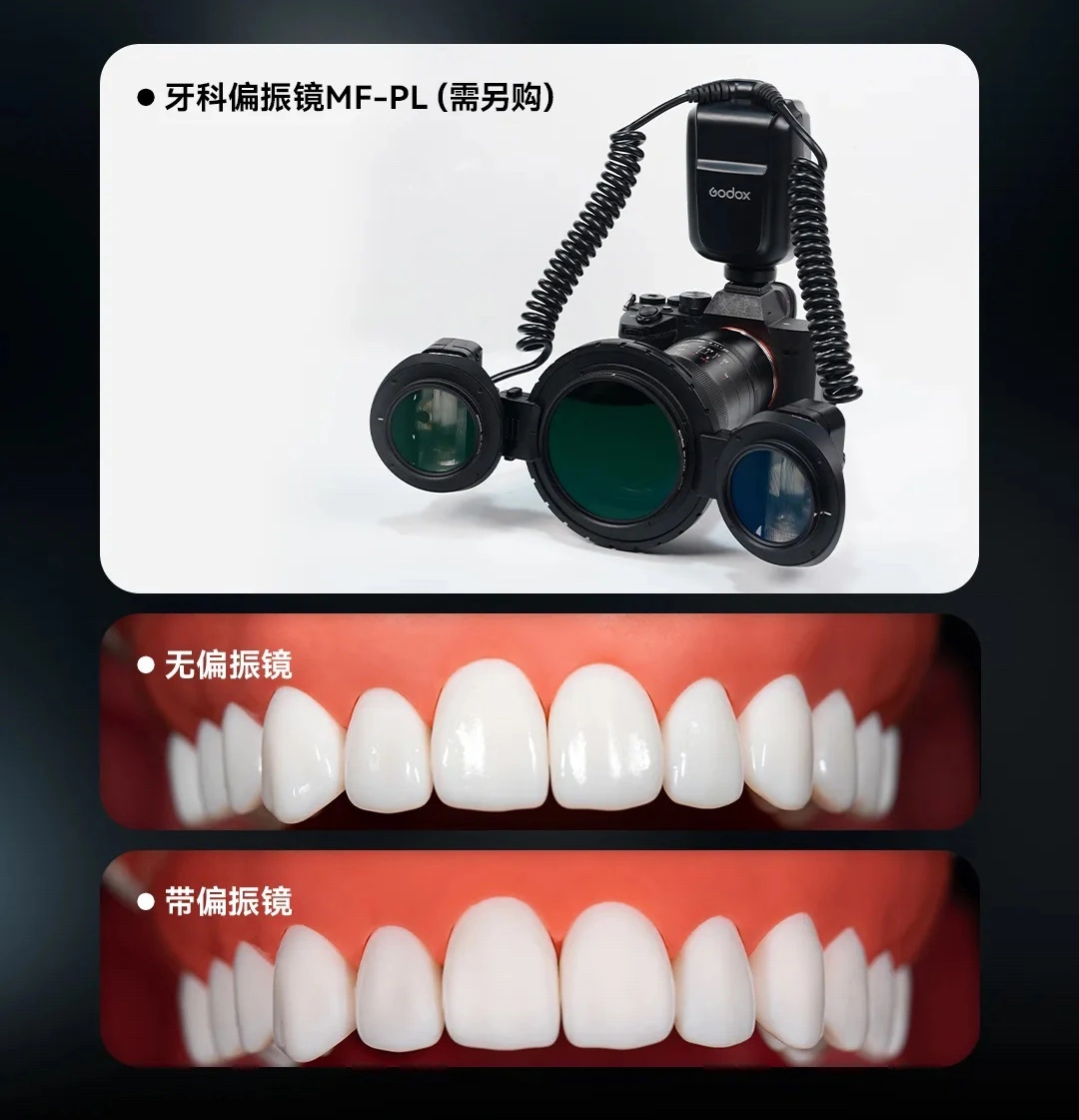 神牛 MF-T76 微距双头闪光灯开售:TTL 自动闪光、1.2s 高速回电,1299 元