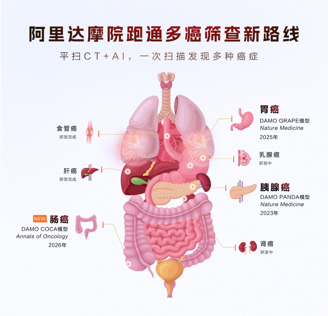 阿里达摩院 AI 全球首次实现肠癌“无感”检测,登上国际肿瘤学顶刊 图片