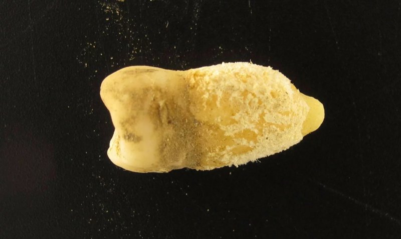 700-year-old tooth reveals European bacterium was in South America before Columbus 700-year-old tooth reveals European bacterium was in South America before Columbus