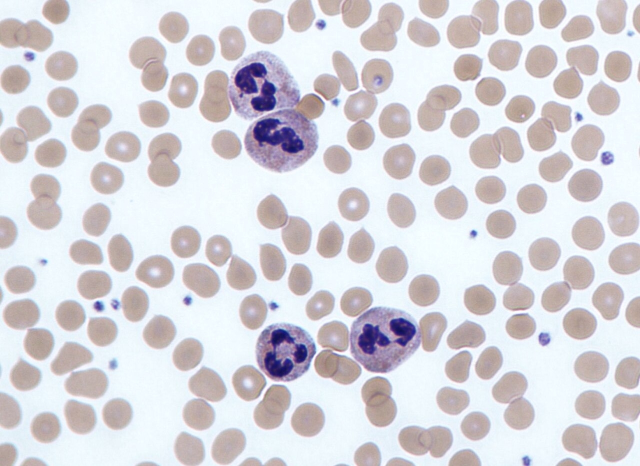 Нейтрофилы в мазке крови (&nbsp;https://commons.wikimedia.org/wiki/File:Neutrophils.jpg, под&nbsp;https://creativecommons.org/licenses/by-sa/3.0/deed.en)