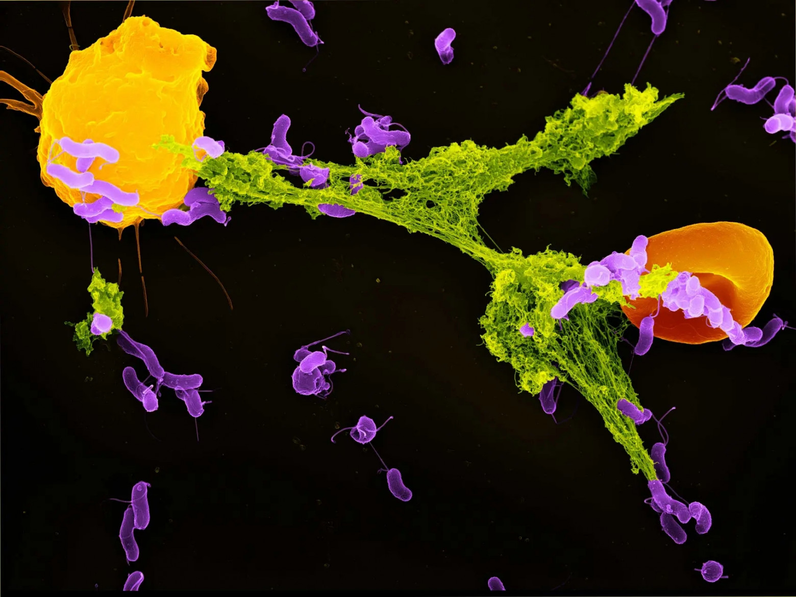 Витальный нетоз (https://www.mpiib-berlin.mpg.de/2065118/neutrophil-ex.., картинка этого уважаемого джентльмена Volker Brinkmann; желтое – нейтрофил, красное – эритроцит, зеленые нитки – NET, фиолетовые – бактерии)