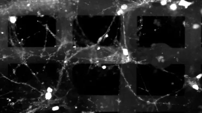 融合活体脑细胞与电子技术,新型生物计算机可完成模式识别