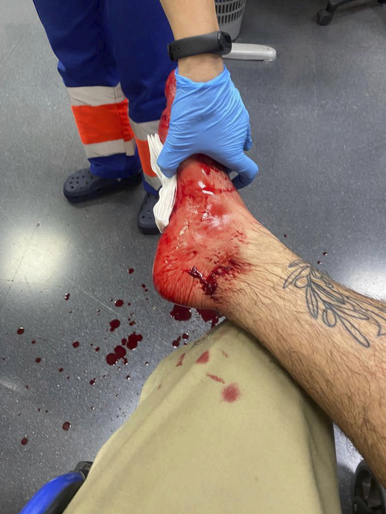 Imagen del pie herido de la v�ctima.