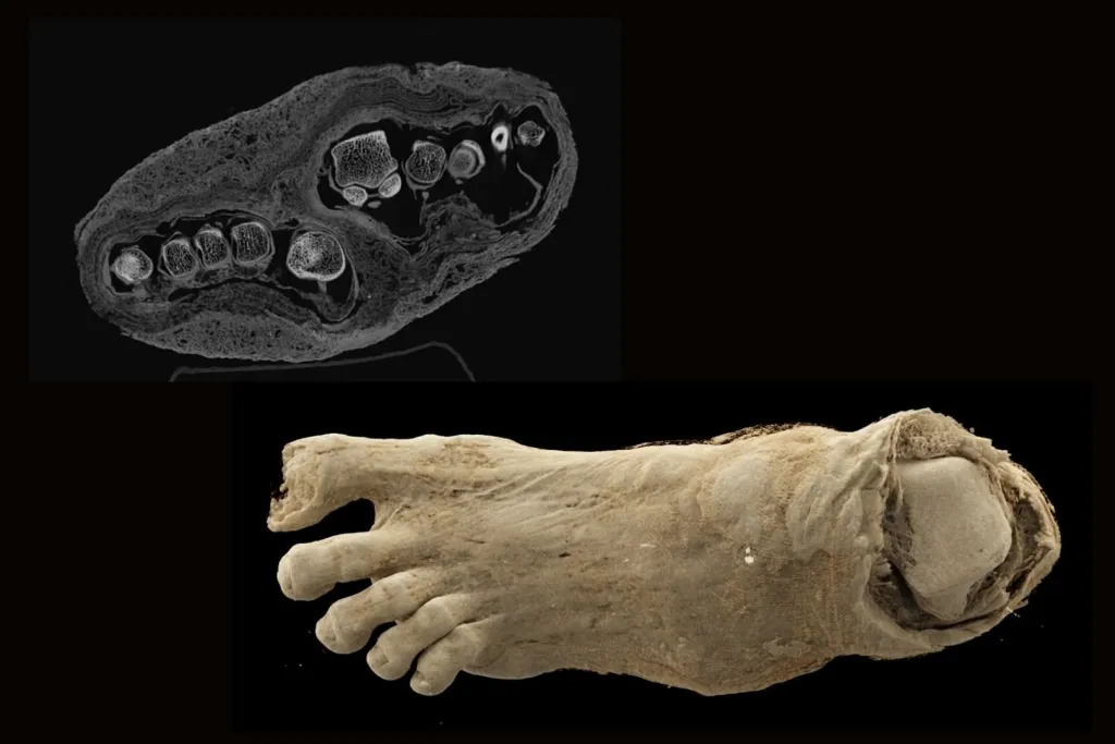 Imagen combinada de un pie momificado egipcio de más de 2.300 años y su escaneo por tomografía, cuya estructura interna ha permitido corregir errores de identificación y revelar nuevos detalles sobre su estado de conservación y anatomía