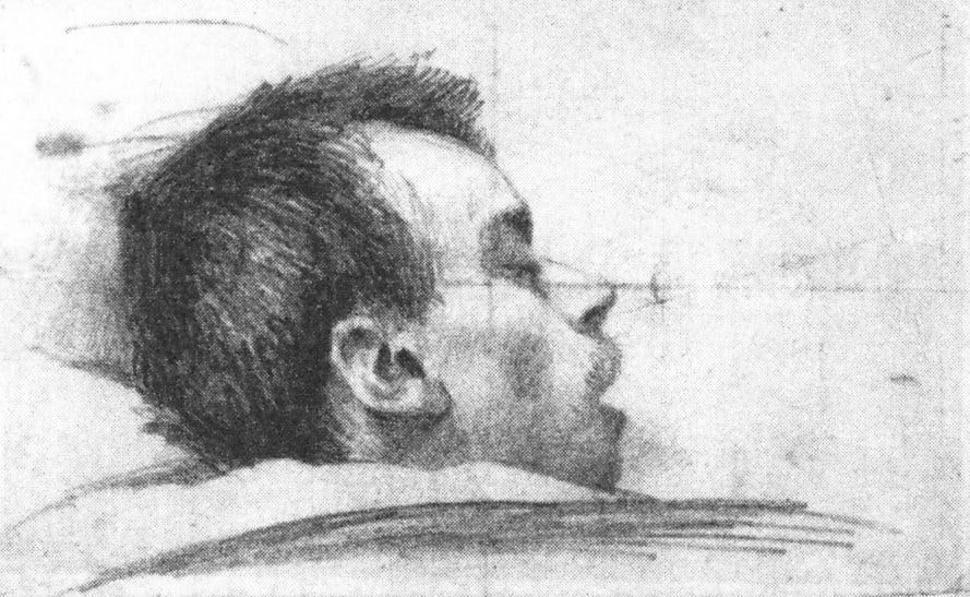 File:Wilky James recovering from his wounds.jpg