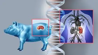 LIFE-GIVING GRAFT: Genetic engineering of pigs makes xenotransplantation more feasible LIFE-GIVING GRAFT: Genetic engineering of pigs makes xenotransplantation more feasible