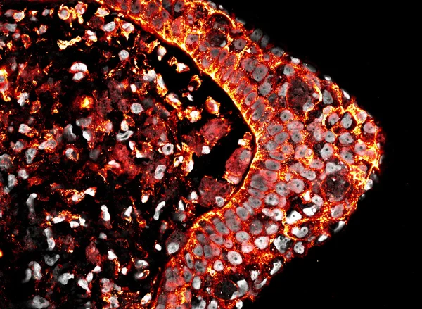 A red-and-yellow membrane label with gray nuclei